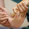 Возможности восстановления движений спастичной руки после инсульта в позднем периоде - stimul-ural.ru - Екатеринбург